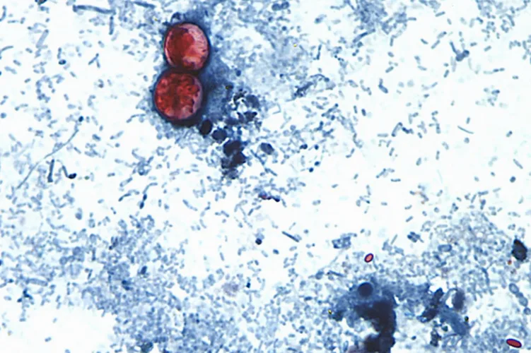 Michigan reports the first 2 US deaths related to a diarrhea-causing parasite